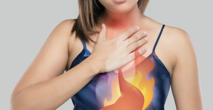 acid reflux depiction